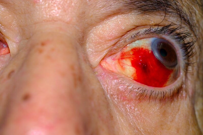 Lesiones oculares: tratamiento médico y derechos de las víctimas
