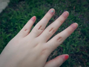 Photo of hand with close up fingers.